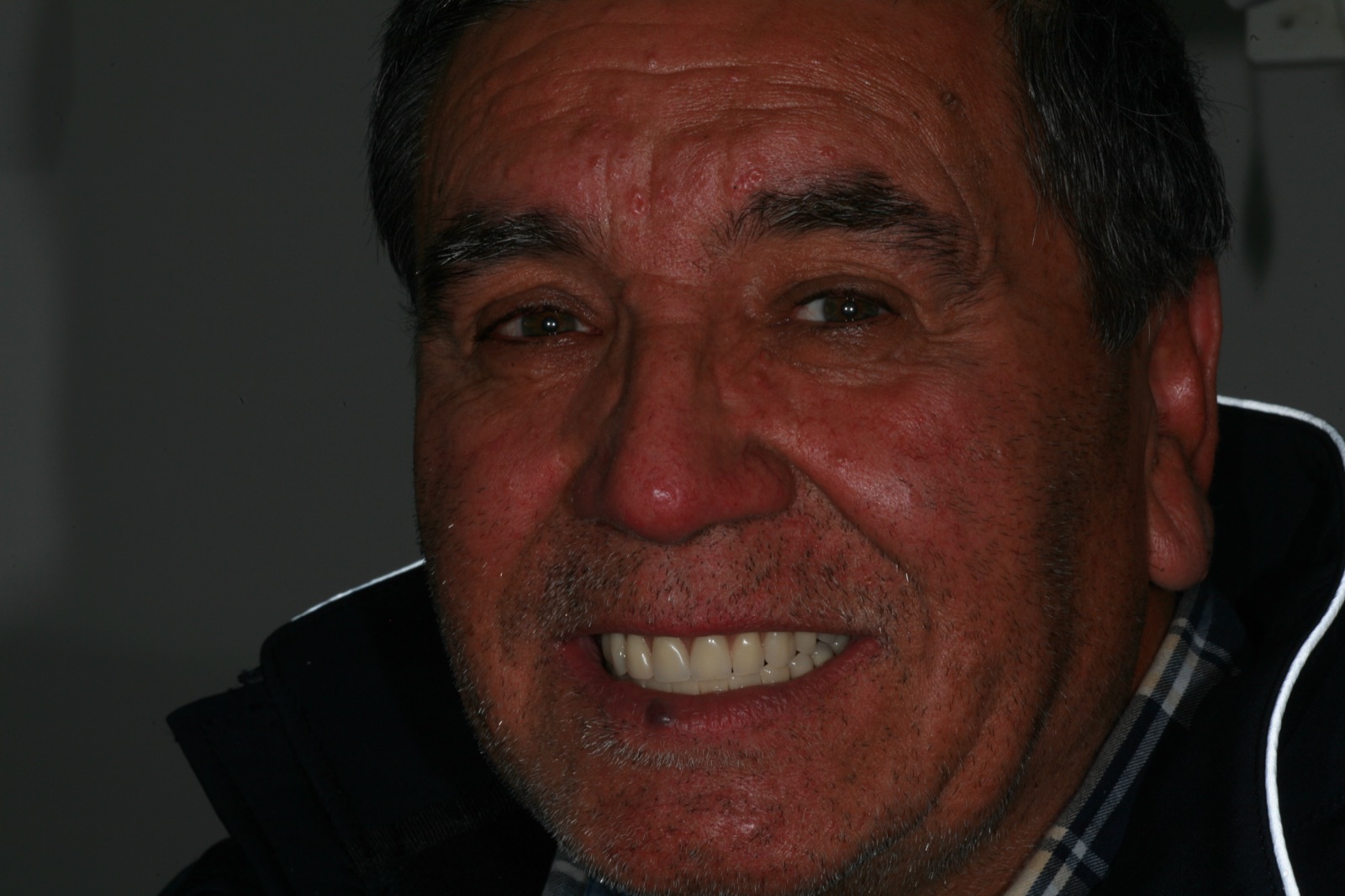 Caso real — resultado: paciente sonriendo con su rehabilitación oral completa